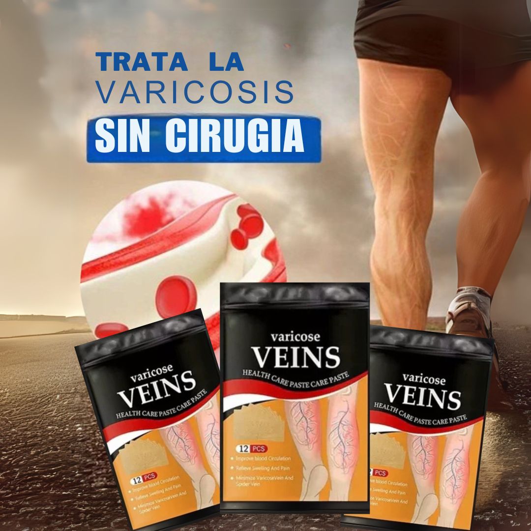 Paga 2 y lleva uno gratis. Tratamiento venas varicosas